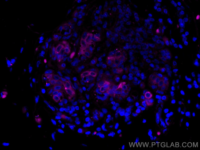 Cytokeratin 19 Antibody in Immunohistochemistry (Paraffin) (IHC (P))