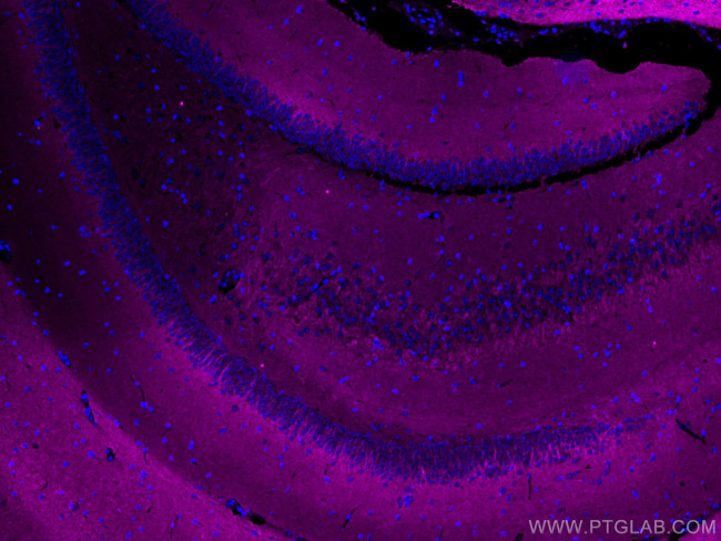 P2RY1 Antibody in Immunohistochemistry (Paraffin) (IHC (P))