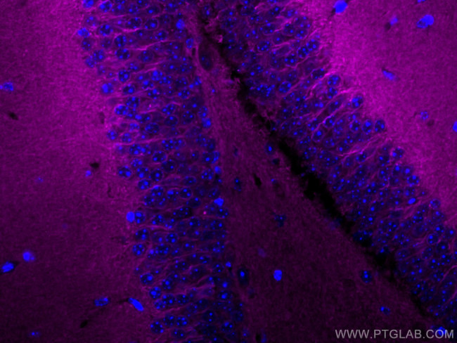 P2RY1 Antibody in Immunohistochemistry (Paraffin) (IHC (P))