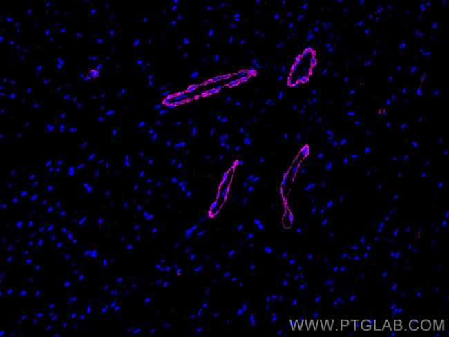 smooth muscle actin Antibody in Immunohistochemistry (Paraffin) (IHC (P))