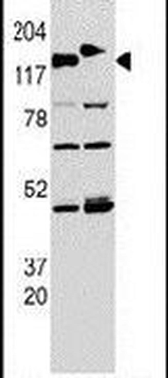 CLASP2 Antibody in Western Blot (WB)