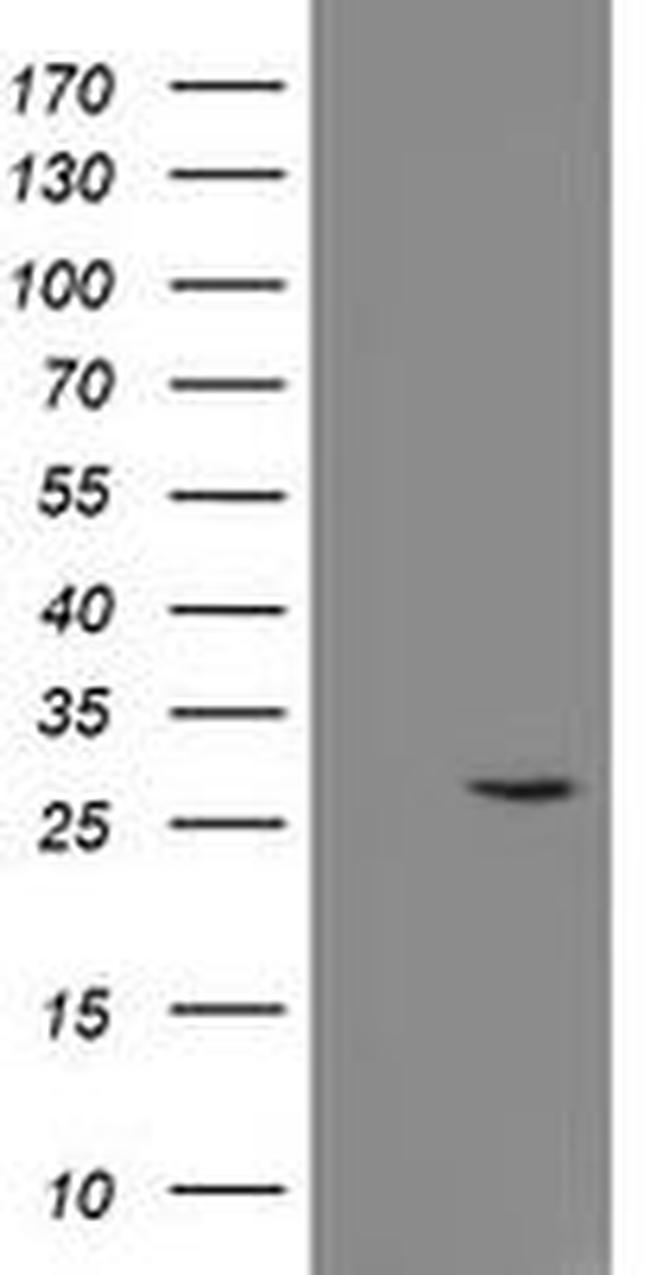 CLEC4E Antibody in Western Blot (WB)