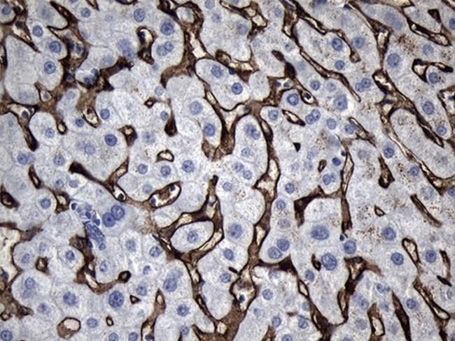 CLEC4M Antibody in Immunohistochemistry (Paraffin) (IHC (P))