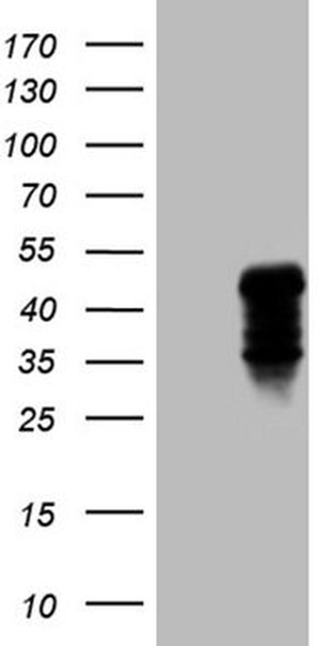 CLEC4M Antibody in Western Blot (WB)