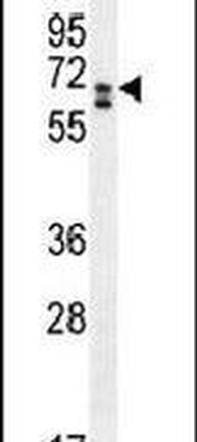 CLIP3 Antibody in Western Blot (WB)