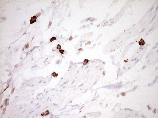 CLOCK Antibody in Immunohistochemistry (Paraffin) (IHC (P))