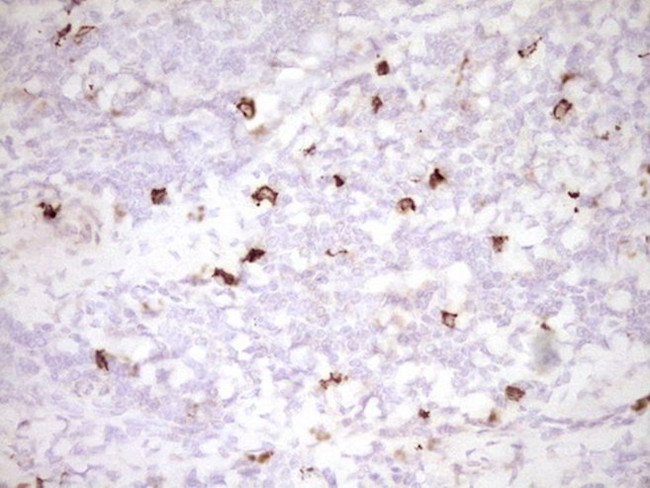 CLOCK Antibody in Immunohistochemistry (Paraffin) (IHC (P))