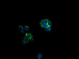 CLPP Antibody in Immunocytochemistry (ICC/IF)
