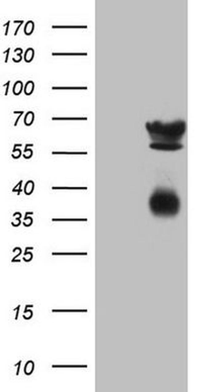 CLU Antibody in Western Blot (WB)