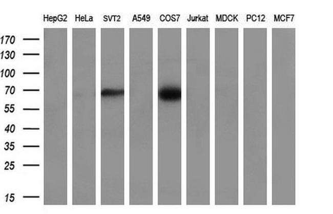 CLU Antibody in Western Blot (WB)