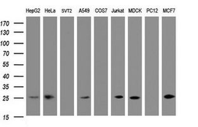 CMPK1 Antibody in Western Blot (WB)