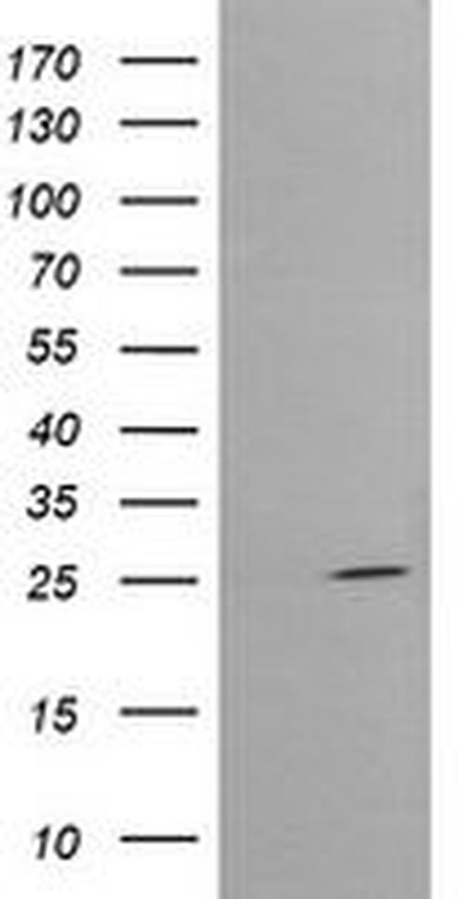 CMPK1 Antibody in Western Blot (WB)