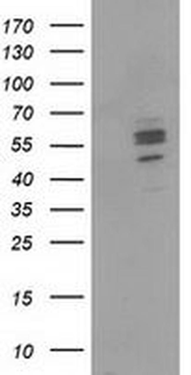 CNDP1 Antibody in Western Blot (WB)