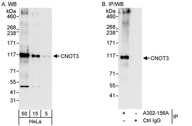 CNOT3 Antibody in Western Blot (WB)