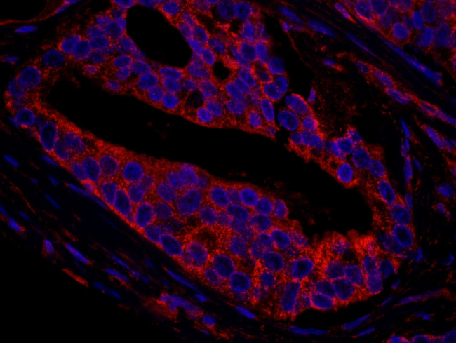 CNOT3 Antibody in Immunohistochemistry (IHC)