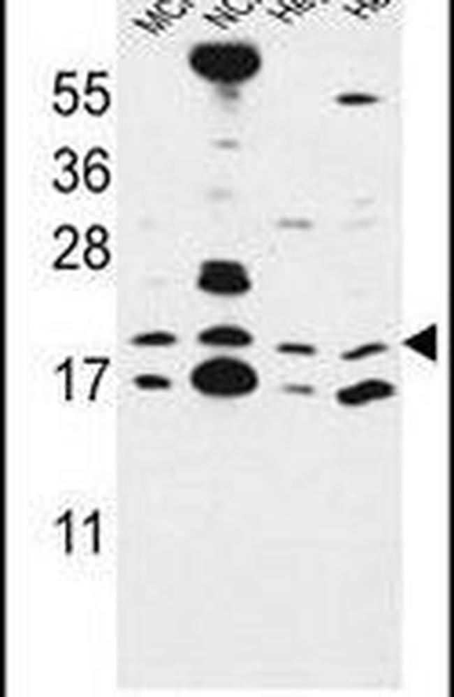 CNPY2 Antibody in Western Blot (WB)