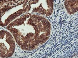 COASY Antibody in Immunohistochemistry (Paraffin) (IHC (P))