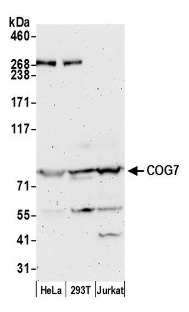 COG7 Antibody in Western Blot (WB)