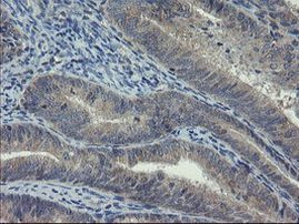 COMMD1 Antibody in Immunohistochemistry (Paraffin) (IHC (P))