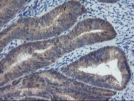 COMMD1 Antibody in Immunohistochemistry (Paraffin) (IHC (P))