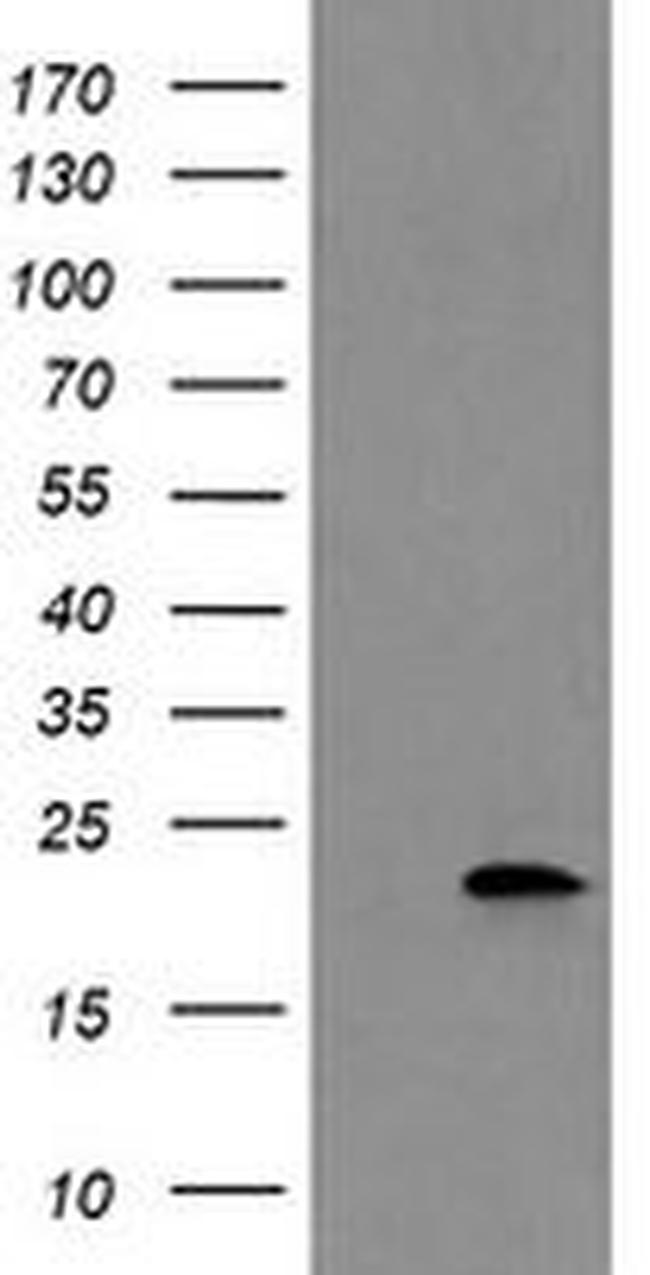 COMMD1 Antibody in Western Blot (WB)