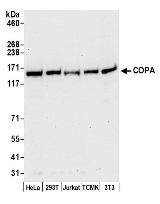 COPA Antibody in Western Blot (WB)