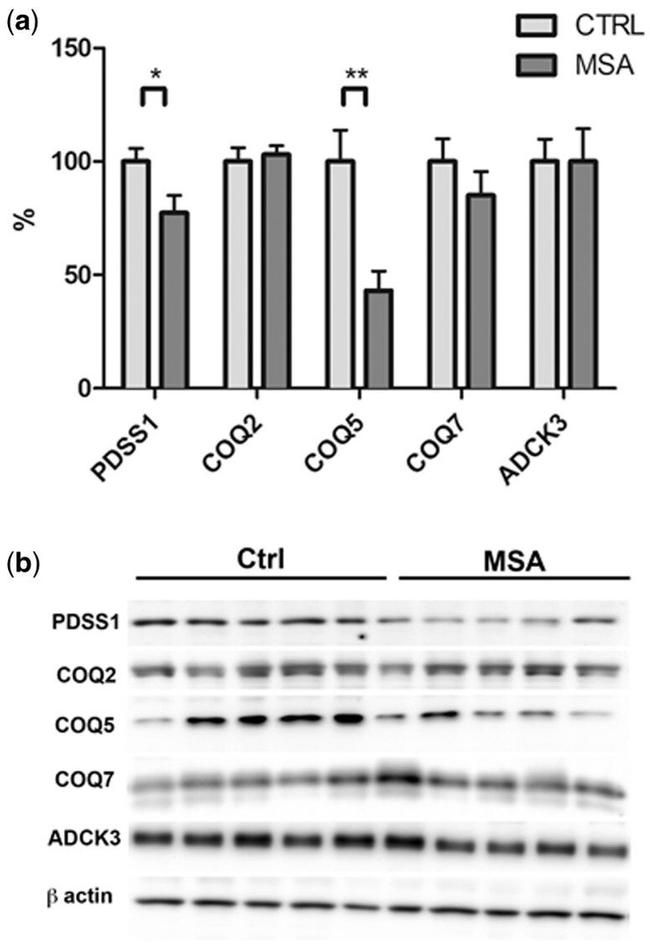 COQ5 Antibody in Western Blot (WB)