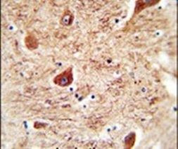 Coronin 7 Antibody in Immunohistochemistry (IHC)