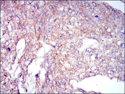 COTL1 Antibody in Immunohistochemistry (Paraffin) (IHC (P))