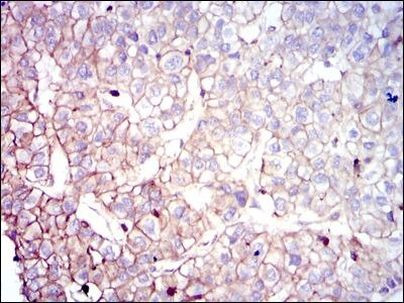 COTL1 Antibody in Immunohistochemistry (Paraffin) (IHC (P))