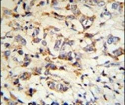 CPN2 Antibody in Immunohistochemistry (IHC)