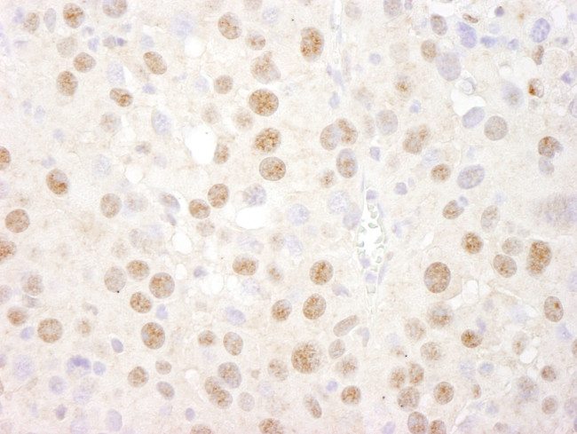 CREB Antibody in Immunohistochemistry (IHC)