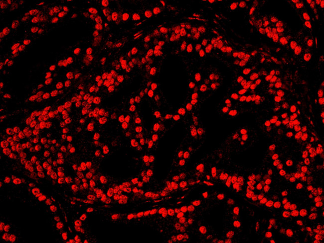 CREB Antibody in Immunohistochemistry (IHC)