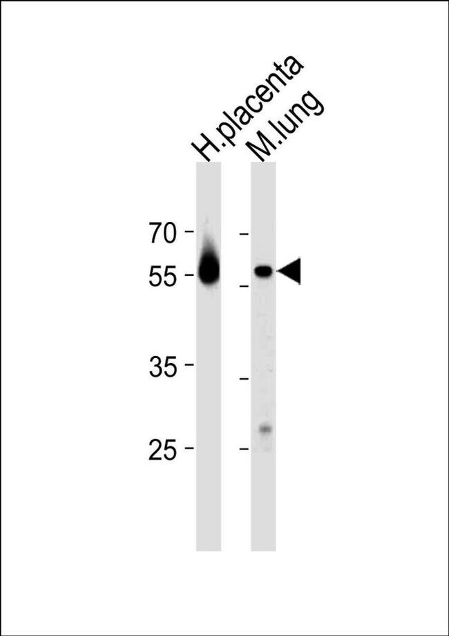 CREB3L2 Antibody in Western Blot (WB)