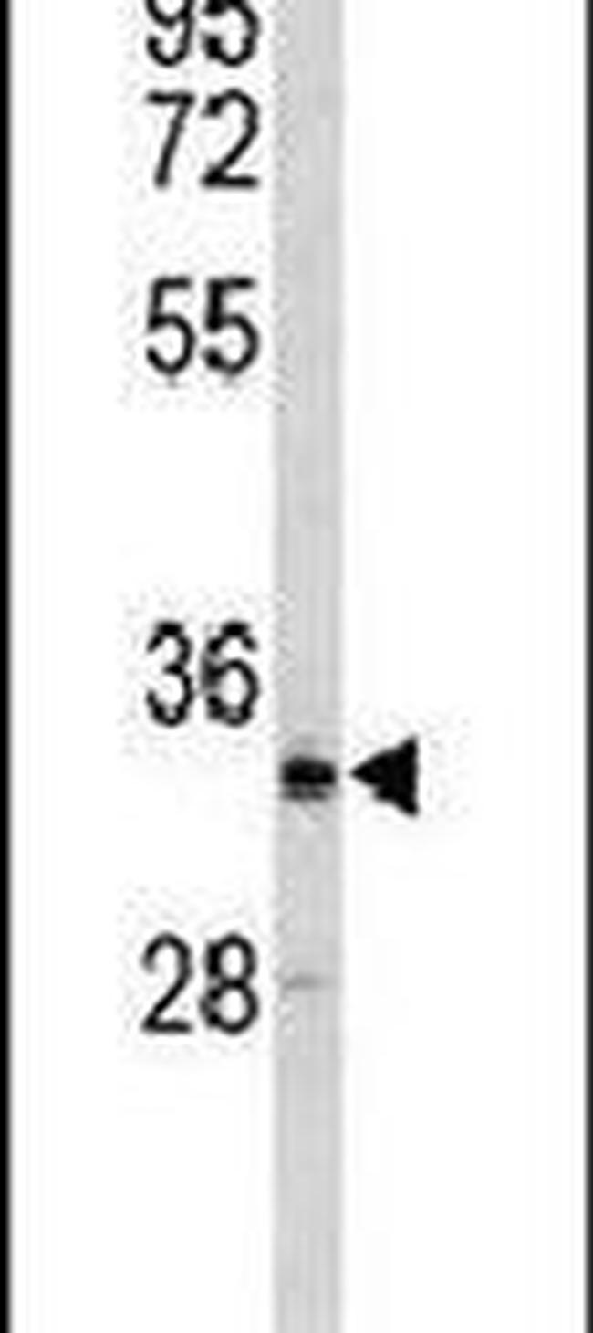 CRELD2 Antibody in Western Blot (WB)