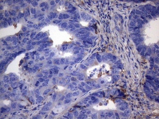 CRP Antibody in Immunohistochemistry (Paraffin) (IHC (P))