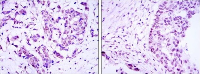 CRTC3 Antibody in Immunohistochemistry (Paraffin) (IHC (P))