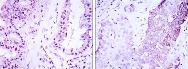 CRTC3 Antibody in Immunohistochemistry (Paraffin) (IHC (P))