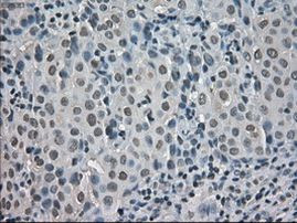 CRYAB Antibody in Immunohistochemistry (Paraffin) (IHC (P))