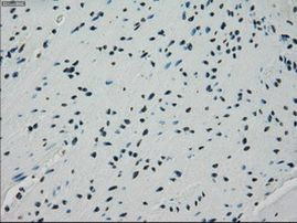 CRYAB Antibody in Immunohistochemistry (Paraffin) (IHC (P))