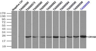 CRYAB Antibody in Immunoprecipitation (IP)