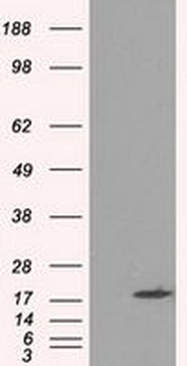 CRYAB Antibody in Western Blot (WB)