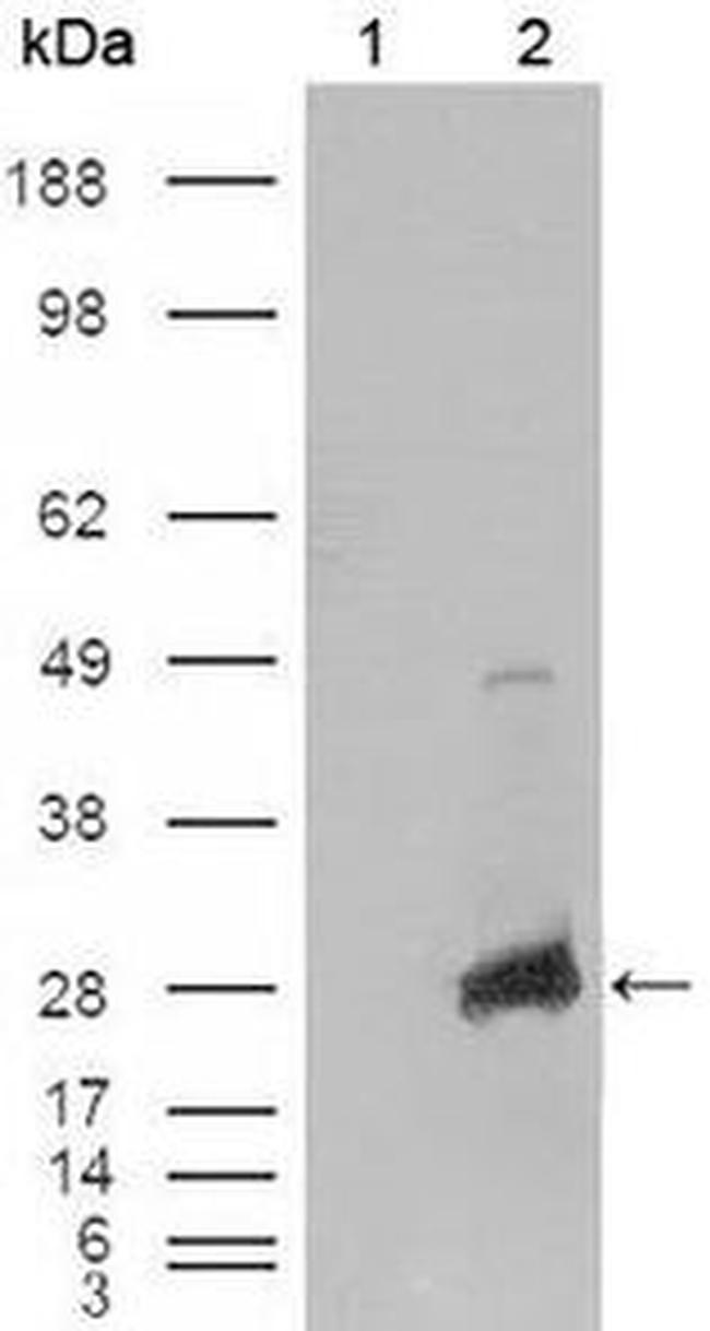 CRYAB Antibody in Western Blot (WB)