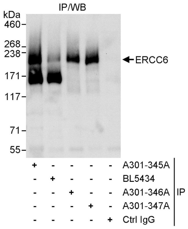 CSB/ERCC6 Antibody in Immunoprecipitation (IP)