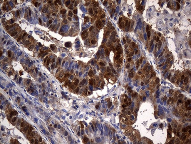 CSE1L Antibody in Immunohistochemistry (Paraffin) (IHC (P))