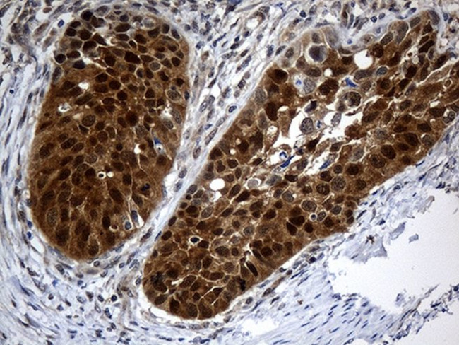 CSE1L Antibody in Immunohistochemistry (Paraffin) (IHC (P))