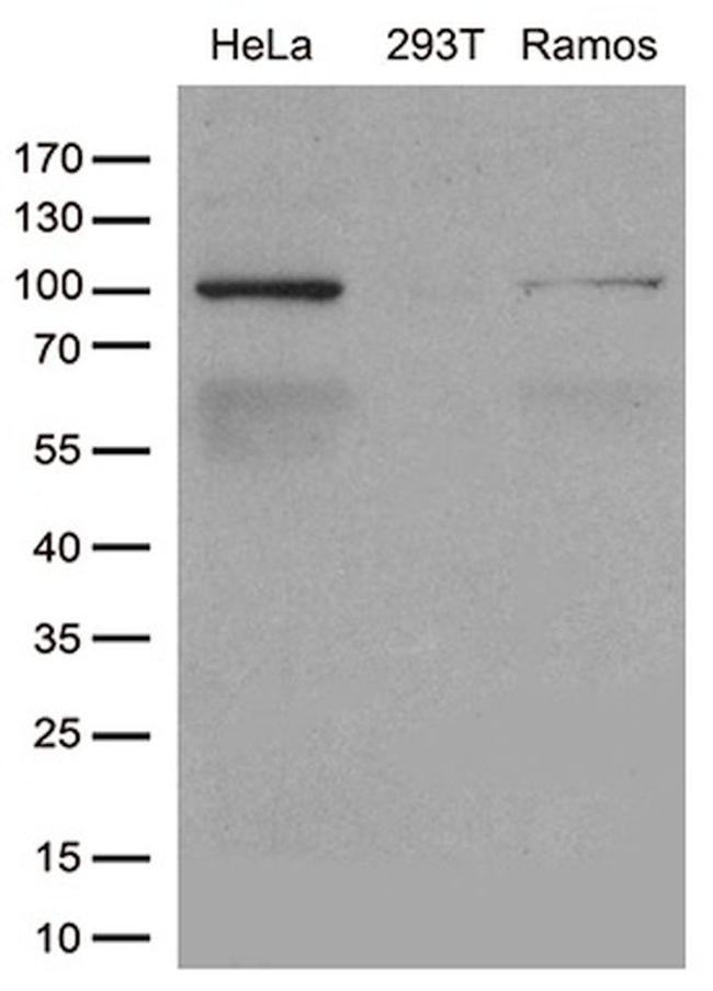 CSE1L Antibody in Western Blot (WB)