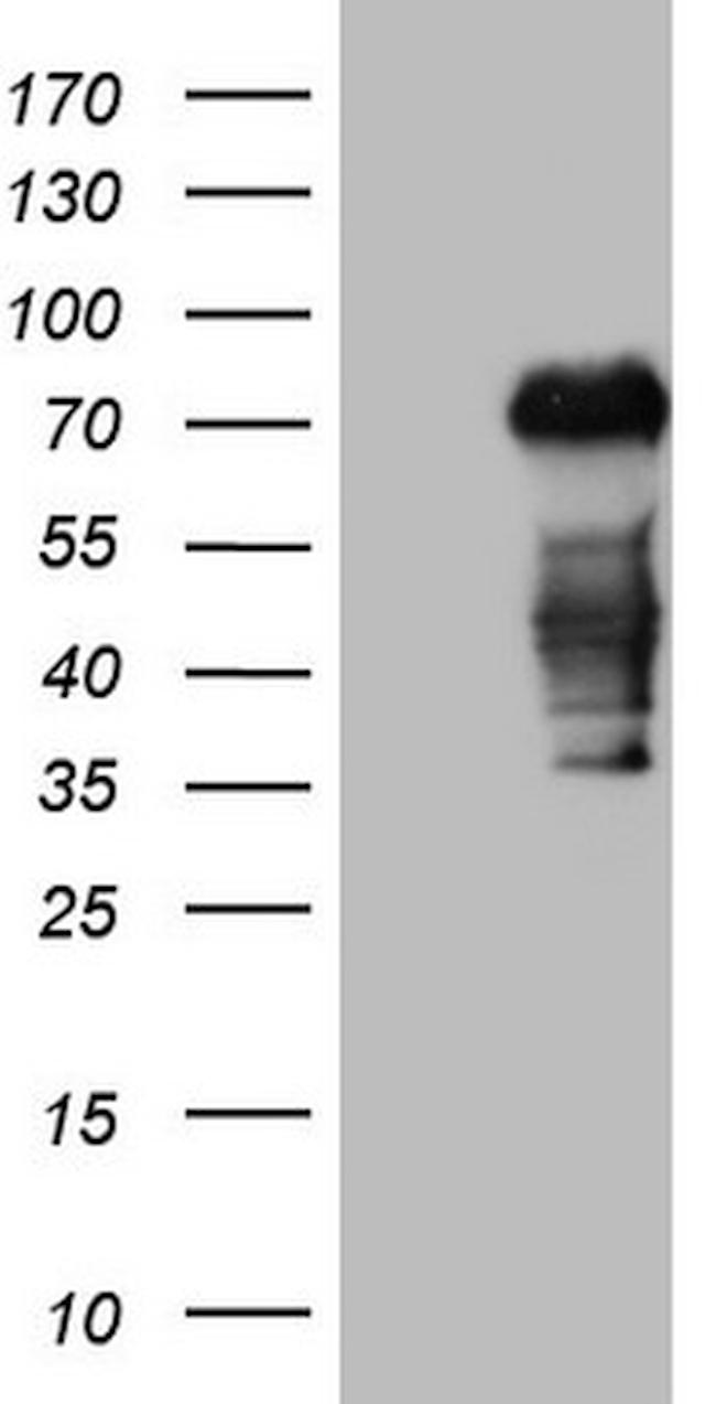 CSF1 Antibody in Western Blot (WB)
