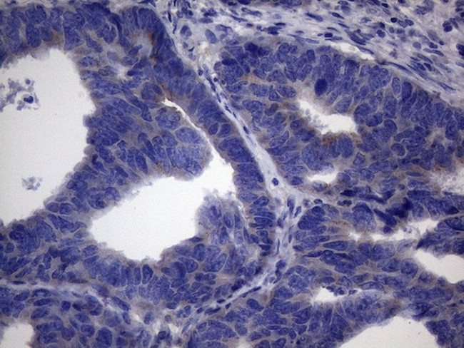 CSF2 Antibody in Immunohistochemistry (Paraffin) (IHC (P))