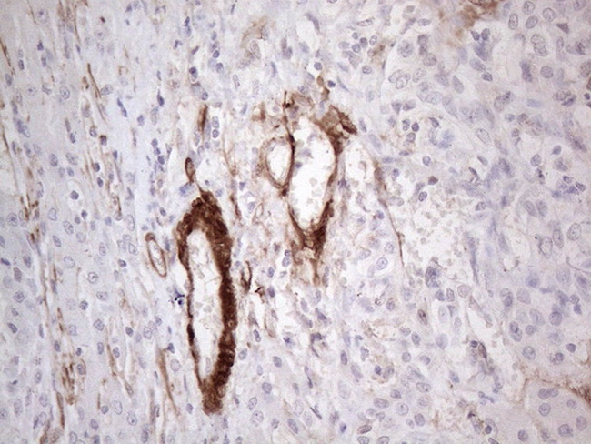 CSF2 Antibody in Immunohistochemistry (Paraffin) (IHC (P))